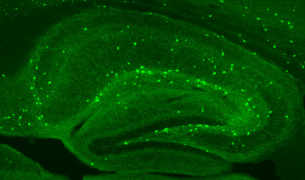 GAD65/gfp